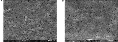 Chemical Modification of Bacterial Cellulose for the Development of an Antibacterial Wound Dressing